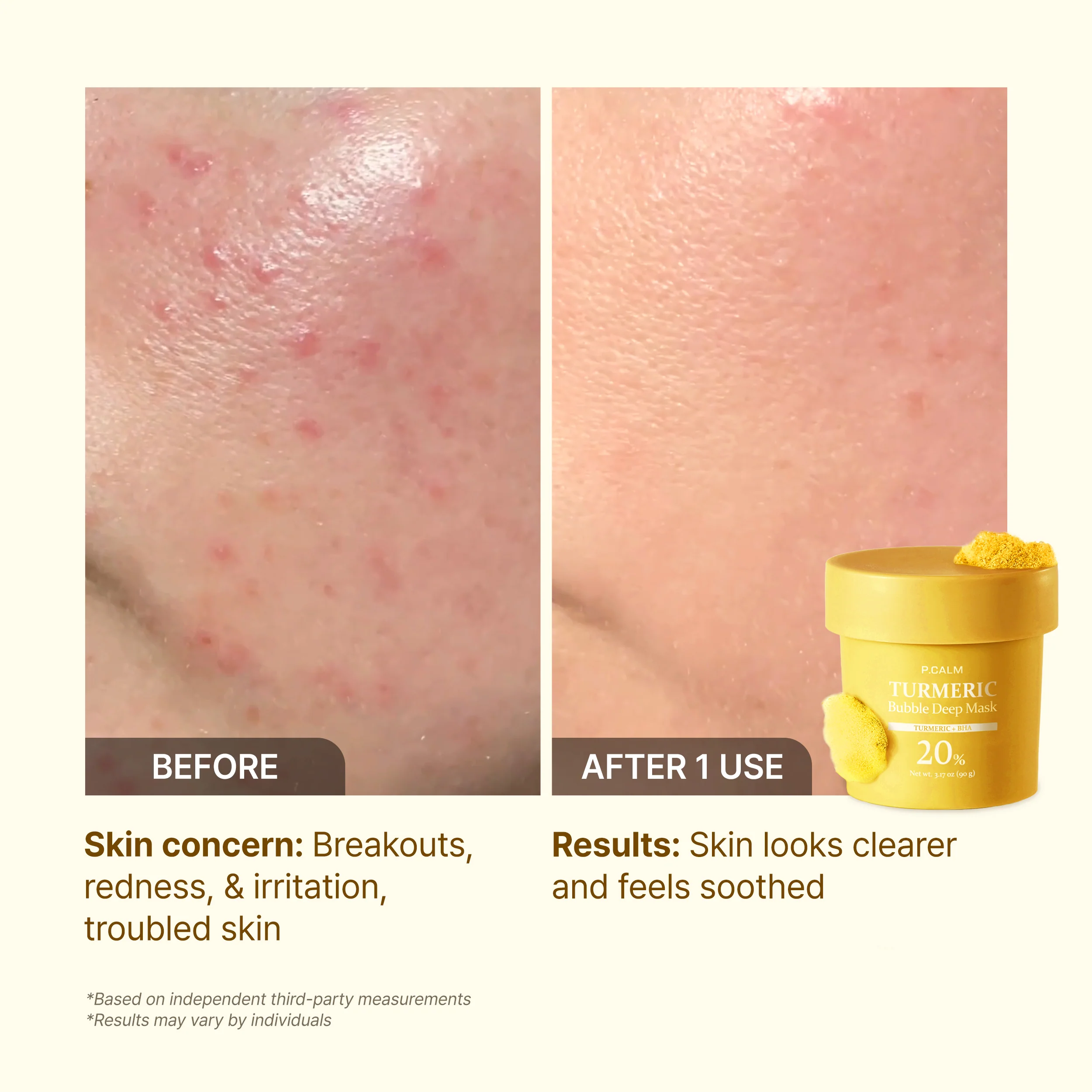 P.CALM TURMERIC BUBBLE DEEP MASK – Imaginea 4